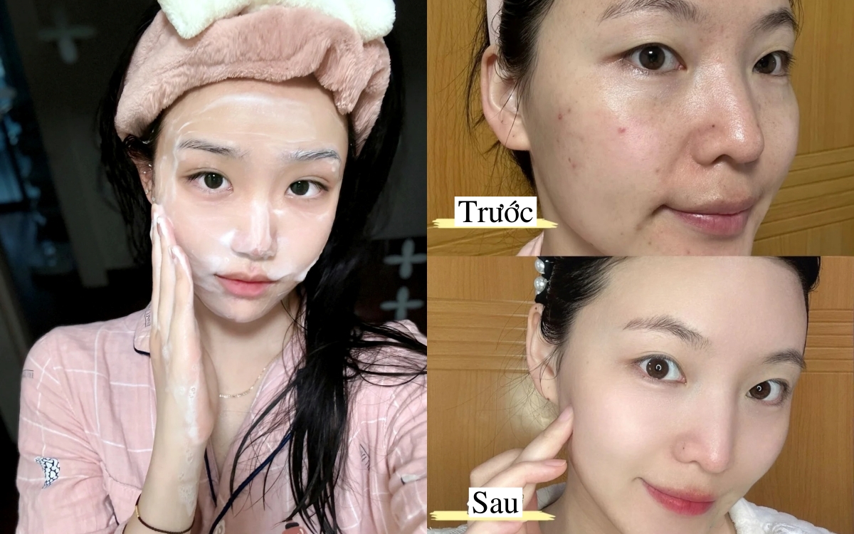 6 sữa rửa mặt đánh bay mụn đầu đen, làm sạch sâu lỗ chân lông mà không gây khô da - Ảnh 1. 6 sữa rửa mặt đánh bay mụn đầu đen, làm sạch sâu lỗ chân lông mà không gây khô da - Ảnh 1.
