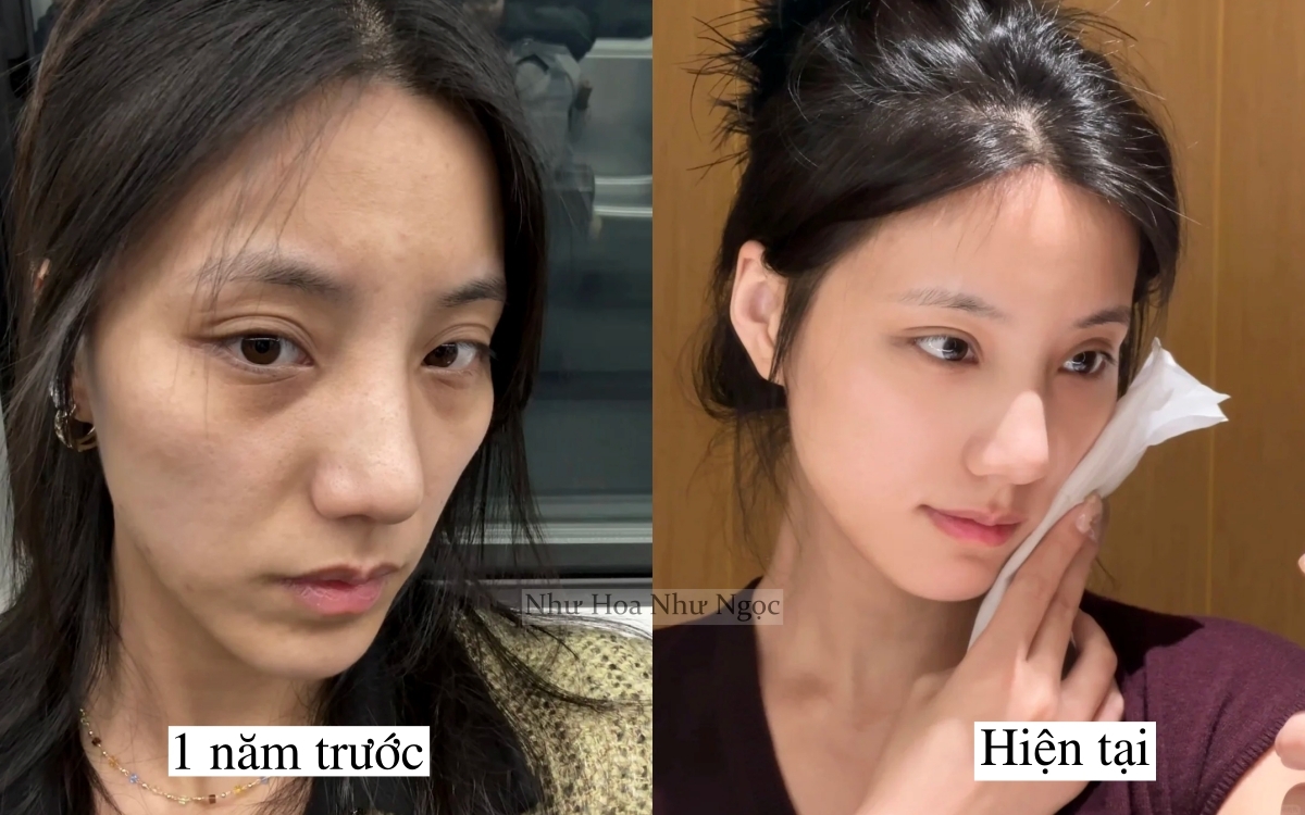 Tôi lấy lại làn da tuổi 20 nhờ 1 năm ngủ sớm, ăn lành và chăm da đúng cách - Ảnh 3. Tôi lấy lại làn da tuổi 20 nhờ 1 năm ngủ sớm, ăn lành và chăm da đúng cách - Ảnh 3.
