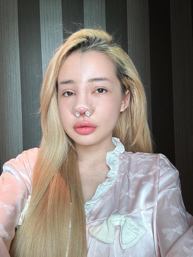 Ngân 98 và những cú lộ mặt mộc gây sốc tâm lý - Ảnh 11. Ngân 98 và những cú lộ mặt mộc gây sốc tâm lý - Ảnh 11.