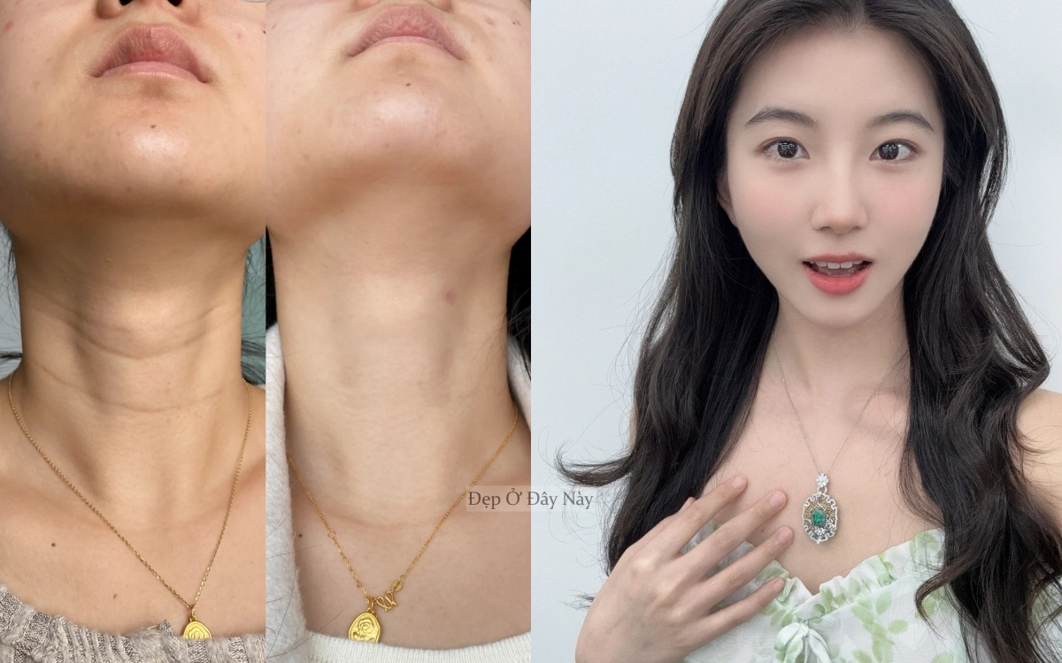 Bí kíp của phụ nữ Trung Quốc: Chỉ 15 phút mỗi ngày để "là phẳng" nếp nhăn vùng cổ - Ảnh 1. Bí kíp của phụ nữ Trung Quốc: Chỉ 15 phút mỗi ngày để "là phẳng" nếp nhăn vùng cổ - Ảnh 1.