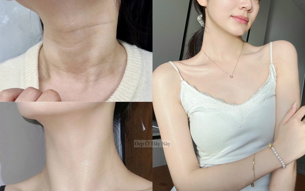 Bí kíp của phụ nữ Trung Quốc: Chỉ 15 phút mỗi ngày để "là phẳng" nếp nhăn vùng cổ - Ảnh 2. Bí kíp của phụ nữ Trung Quốc: Chỉ 15 phút mỗi ngày để "là phẳng" nếp nhăn vùng cổ - Ảnh 2.