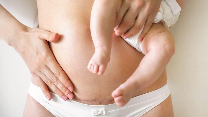 Sản phụ sinh mổ có nguy cơ đau đớn và rối loạn giấc ngủ cao hơn sản phụ sinh thường- Ảnh 1. Sản phụ sinh mổ có nguy cơ đau đớn và rối loạn giấc ngủ cao hơn sản phụ sinh thường- Ảnh 1.