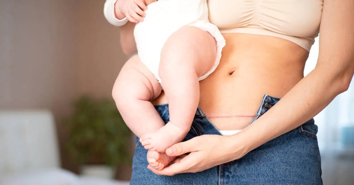 Sản phụ sinh mổ có nguy cơ đau đớn và rối loạn giấc ngủ cao hơn sản phụ sinh thường- Ảnh 3. Sản phụ sinh mổ có nguy cơ đau đớn và rối loạn giấc ngủ cao hơn sản phụ sinh thường- Ảnh 3.