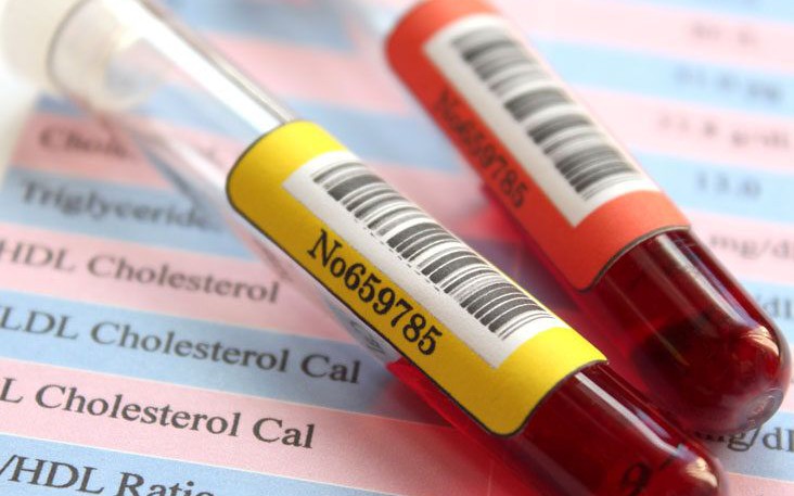 cholesterol-testthumb-1-732x549-1760753591994448121607-1760757587571-1760757592950925850204-46-0-503-732-crop-17607576491221275594534.jpg
