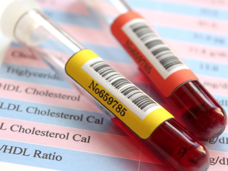 cholesterol-testthumb-1-732x549-1760753591994448121607-1760757587571-1760757592950925850204.jpg