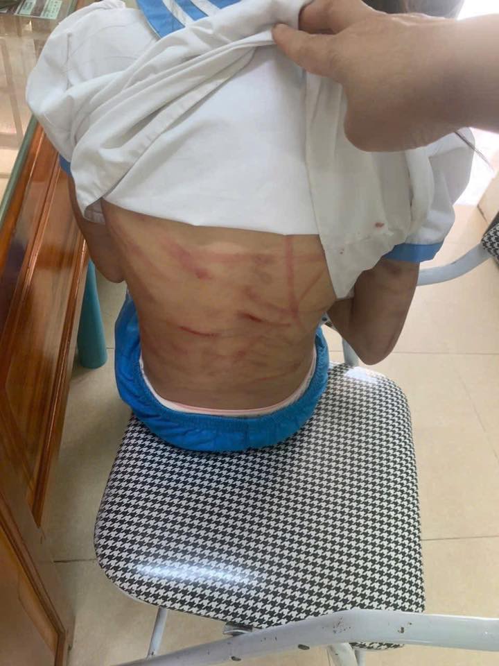 Xác minh thông tin bé gái nghi bị cha dượng bạo hành - Ảnh 1. Xác minh thông tin bé gái lớp 5 bị cha dượng bạo hành - Ảnh 1.