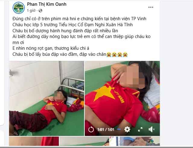 Xác minh thông tin bé gái nghi bị cha dượng bạo hành - Ảnh 4. Xác minh thông tin bé gái lớp 5 bị cha dượng bạo hành - Ảnh 4.