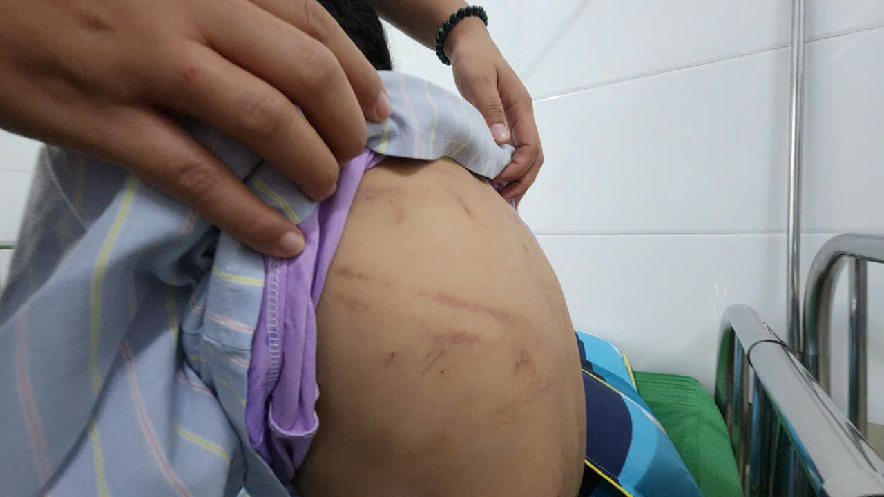 Bé gái bị cha dượng dùng búa bạo hành: Lời kể nghẹn ngào của nạn nhân - Ảnh 2. Bé gái bị cha dượng dùng búa bạo hành: Lời kể nghẹn ngào của nạn nhân - Ảnh 2.