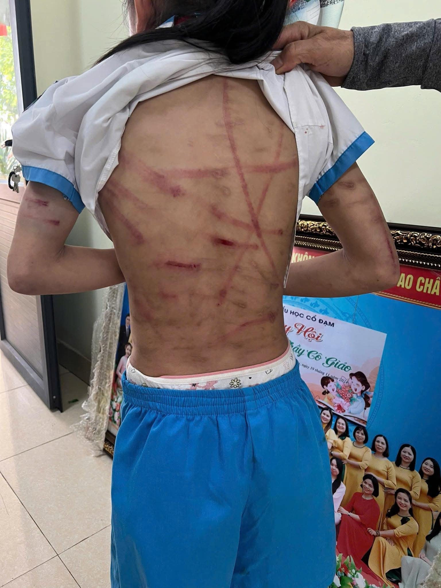 Vụ bé gái lớp 5 ở Hà Tĩnh bị bạo hành: Công an làm việc với người cha dượng - Ảnh 5. Vụ bé gái lớp 5 ở Hà Tĩnh bị bạo hành: Công an làm việc với cha dượng - Ảnh 5.
