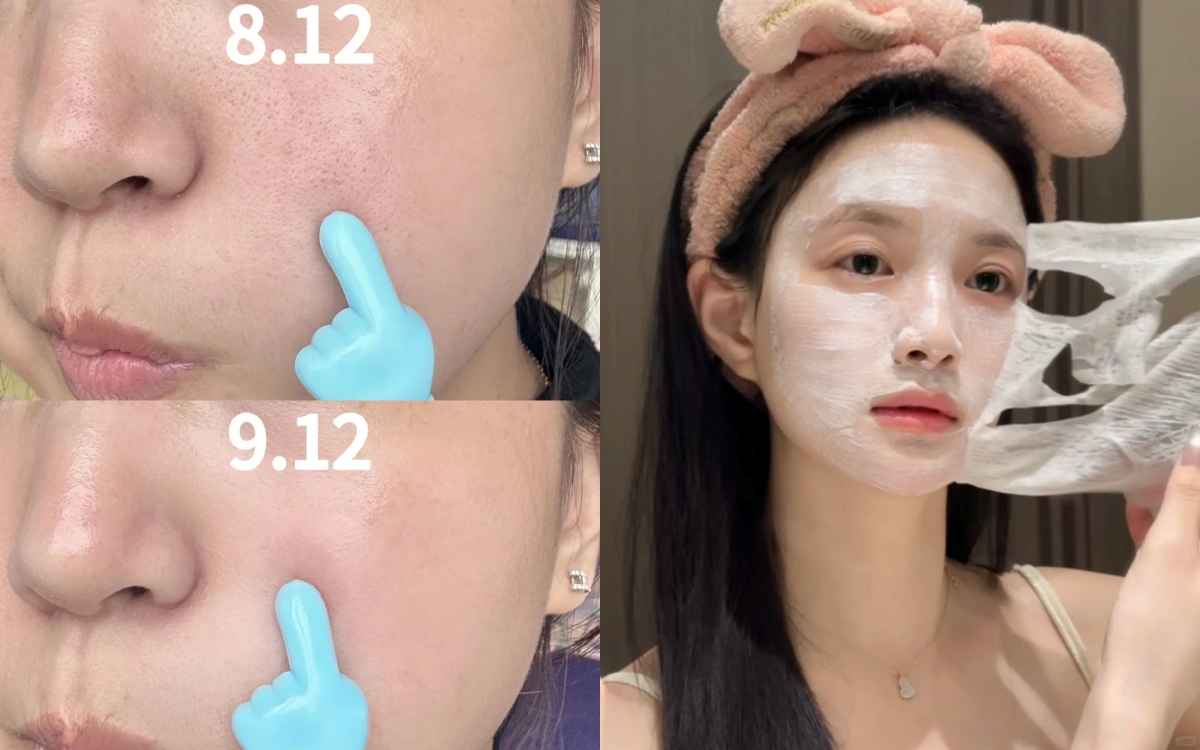 Lỗ chân lông từ to hóa nhỏ, mụn đầu đen biến mất khi đắp loại mặt nạ này mỗi tuần - Ảnh 1. Lỗ chân lông từ to hóa nhỏ, mụn đầu đen biến mất khi đắp loại mặt nạ này mỗi tuần - Ảnh 1.