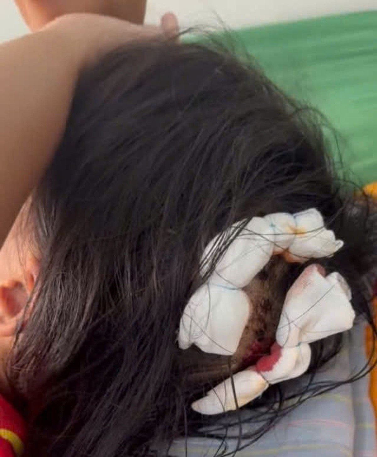 Vụ bé gái lớp 5 ở Hà Tĩnh bị bạo hành: Công an làm việc với người cha dượng - Ảnh 3. Vụ bé gái lớp 5 ở Hà Tĩnh bị bạo hành: Công an làm việc với cha dượng - Ảnh 3.