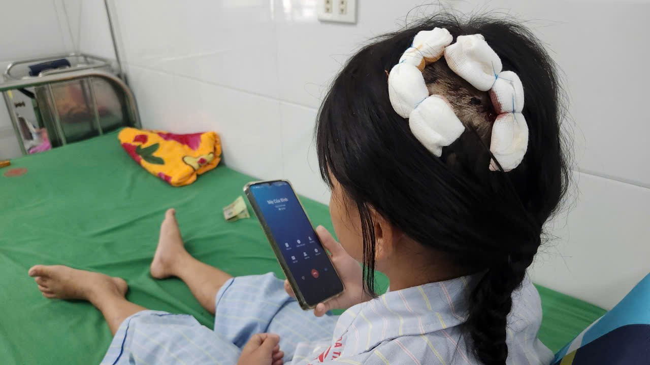 Bé gái bị cha dượng dùng búa bạo hành: Lời kể nghẹn ngào của nạn nhân - Ảnh 1. Bé gái bị cha dượng dùng búa bạo hành: Lời kể nghẹn ngào của nạn nhân - Ảnh 1.