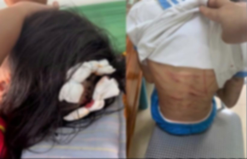 Bé gái lớp 5 nghi bị bố dượng bạo hành đã mở cửa sổ cầu cứu hàng xóm: Thêm loạt chi tiết gây phẫn nộ - Ảnh 1. Bé gái lớp 5 nghi bị bố dượng bạo hành đã mở cửa sổ cầu cứu hàng xóm: Thêm loạt chi tiết gây phẫn nộ - Ảnh 1.