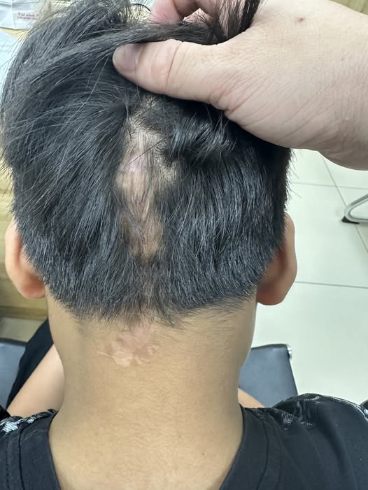 Chỉ có thể là chuyện cổ tích, một đứa trẻ được cứu khỏi bệnh viêm màng não đặc biệt: Mẹ bé khóc, bác sĩ cũng khóc- Ảnh 1. Chỉ có thể là chuyện cổ tích, một đứa trẻ được cứu khỏi bệnh viêm màng não đặc biệt: Mẹ bé khóc, bác sĩ cũng khóc- Ảnh 1.