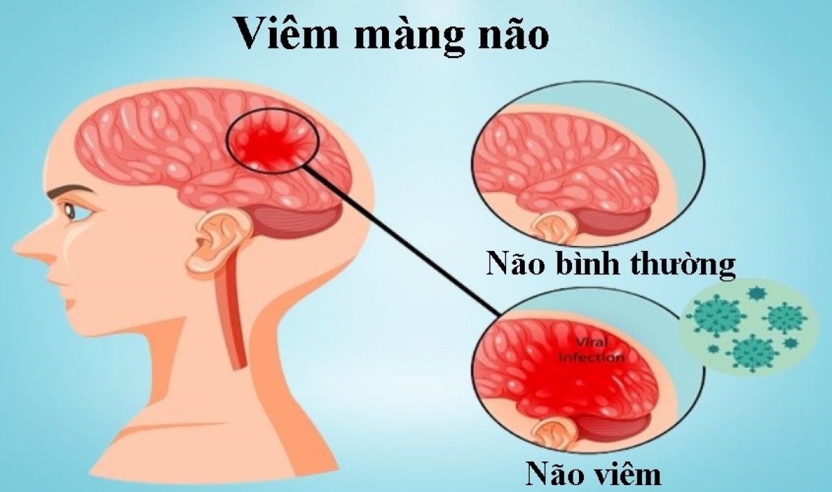 Chỉ có thể là chuyện cổ tích, một đứa trẻ được cứu khỏi bệnh viêm màng não đặc biệt: Mẹ bé khóc, bác sĩ cũng khóc- Ảnh 3. Chỉ có thể là chuyện cổ tích, một đứa trẻ được cứu khỏi bệnh viêm màng não đặc biệt: Mẹ bé khóc, bác sĩ cũng khóc- Ảnh 3.