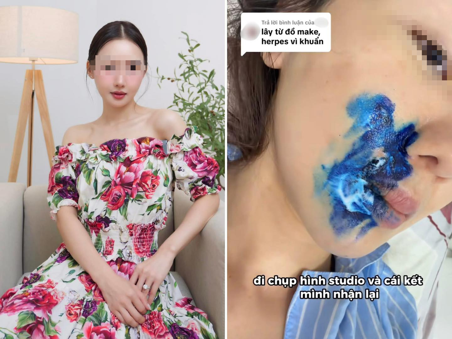 Chi 12 triệu chụp ảnh studio, cô gái khóc ròng vì bị lây virus Herpes: 1 món đồ quen thuộc bị tố cáo!- Ảnh 1. Chi 12 triệu chụp ảnh studio, cô gái khóc ròng vì bị lây virus Herpes: 1 món đồ quen thuộc bị tố cáo!- Ảnh 1.
