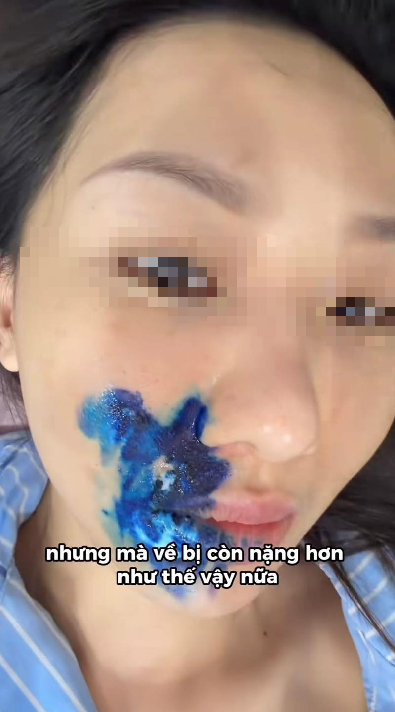 Chi 12 triệu chụp ảnh studio, cô gái khóc ròng vì bị lây virus Herpes: 1 món đồ quen thuộc bị tố cáo!- Ảnh 2. Chi 12 triệu chụp ảnh studio, cô gái khóc ròng vì bị lây virus Herpes: 1 món đồ quen thuộc bị tố cáo!- Ảnh 2.