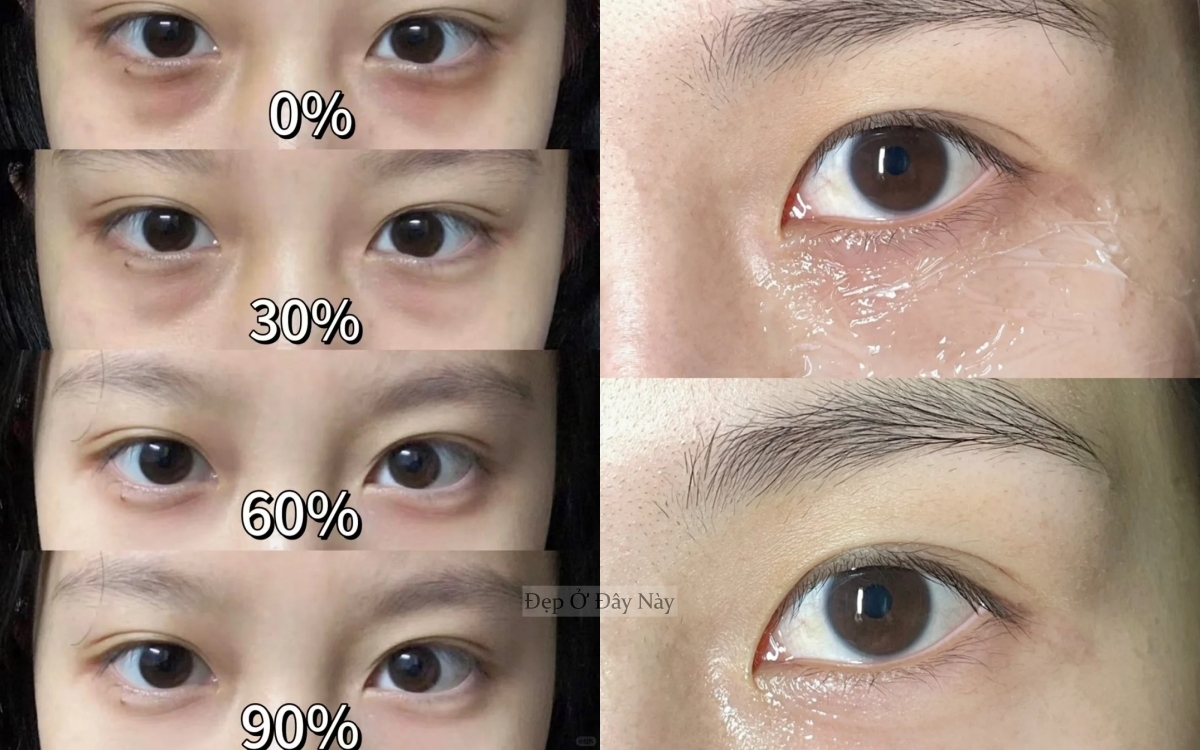 Cách đắp kem mắt giống Phạm Băng Băng khiến quầng thâm và nếp nhăn tự động tiêu biến - Ảnh 4. Cách đắp kem mắt giống Phạm Băng Băng khiến quầng thâm và nếp nhăn tự động tiêu biến - Ảnh 4.