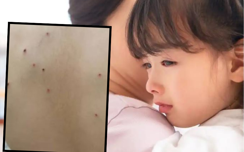 Tắm cho con gái, mẹ phát hiện những vết chấm li ti lạ trên lưng, biết nguyên nhân chị tuyên bố: Không thể nhẫn nhịn!- Ảnh 1. Tắm cho con gái, mẹ phát hiện những vết chấm li ti lạ trên lưng, biết nguyên nhân chị tuyên bố: Không thể nhẫn nhịn!- Ảnh 1.