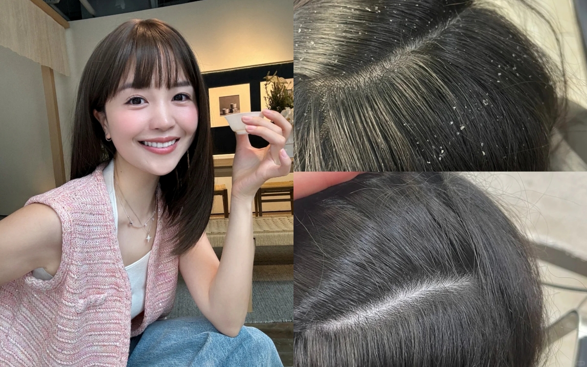 5 dầu gội đặc trị gàu, làm sạch sâu tận chân mà không gây khô tóc - Ảnh 1. 5 dầu gội đặc trị gàu, làm sạch sâu tận chân mà không gây khô tóc - Ảnh 1.