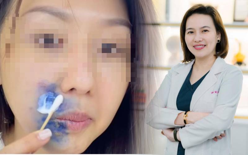 Hiếm gặp: Trẻ mắc đồng thời zona v&agrave; thủy đậu - Ảnh 2.