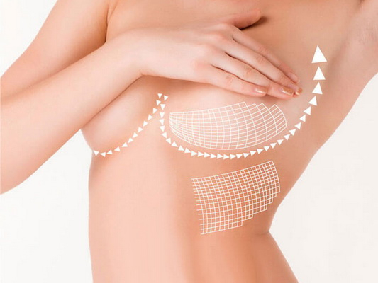 Tái tạo vú: Cuộc hồi sinh của người phụ nữ sau Tái tạo vú: Cuộc hồi sinh của người phụ nữ sau