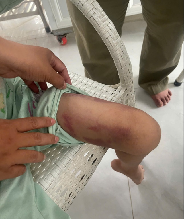 Mẹ ruột và người tình 19 tuổi thay nhau bạo hành dã man con gái 9 tuổi - Ảnh 1. Mẹ ruột và người tình 19 tuổi thay nhau bạo hành dã man con gái 9 tuổi - Ảnh 1.