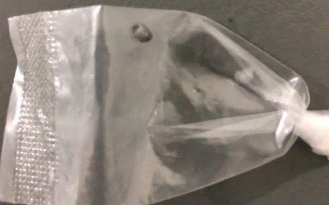 Bé 3 tuổi chảy nước mũi có mùi hôi khó chịu, bác sĩ gắp ra thứ 