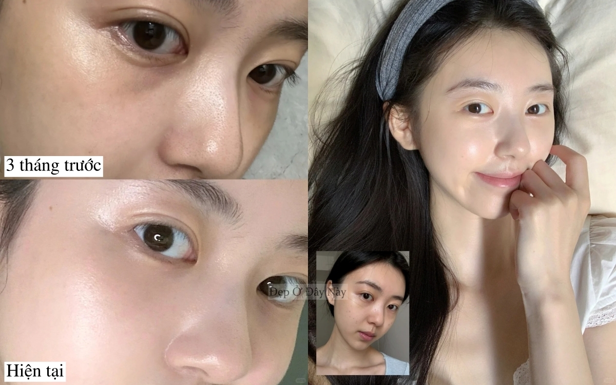 Cô gái bỏ trà sữa 3 tháng, da căng sáng như vừa đi spa dưỡng chuyên sâu - Ảnh 1. Cô gái bỏ trà sữa 3 tháng, da căng sáng như vừa đi spa dưỡng chuyên sâu - Ảnh 1.