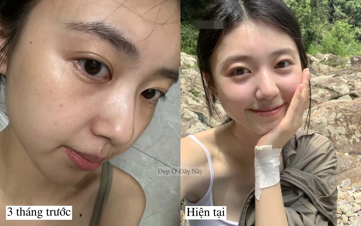 Cô gái bỏ trà sữa 3 tháng, da căng sáng như vừa đi spa dưỡng chuyên sâu - Ảnh 2. Cô gái bỏ trà sữa 3 tháng, da căng sáng như vừa đi spa dưỡng chuyên sâu - Ảnh 2.