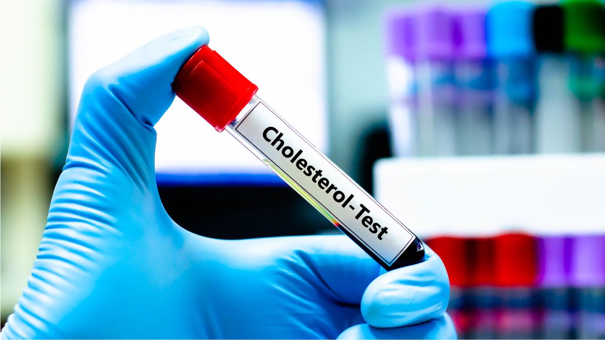 cholesterol-levels-by-age-chart-1761313827599827083990-1761383706280-1761383706354663842937.jpg