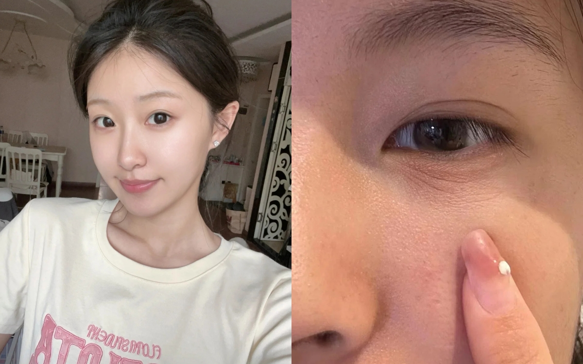 5 lọ kem mắt chứa retinol là "thần dược" giảm nếp nhăn cho những nàng ngoài 30 tuổi - Ảnh 1. 5 lọ kem mắt chứa retinol là "thần dược" giảm nếp nhăn cho những nàng ngoài 30 tuổi - Ảnh 1.