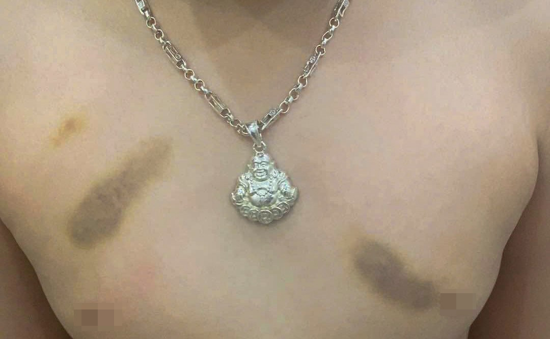C&ocirc; gi&aacute;o mầm non ở Gia Lai bị tố bạo h&agrave;nh trẻ: Buộc th&ocirc;i việc, phạt h&agrave;nh ch&iacute;nh 6,5 triệu đồng - Ảnh 1.