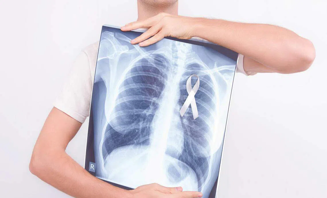 Cậu bé 12 tuổi bị ung thư phổi giai đoạn cuối, người mẹ vô cùng hối hận vì đã cưng chiều con theo cách này- Ảnh 4. Cậu bé 12 tuổi bị ung thư phổi giai đoạn cuối, người mẹ vô cùng hối hận vì đã cưng chiều con theo cách này- Ảnh 4.