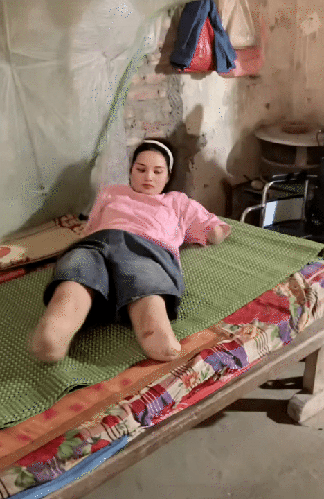 NGA TÍCH CỰC - Kênh Tiktok của mẹ 2 con mất tứ chi sau cơn bạo bệnh: Kiên cường tập luyện với đôi chân  NGA TÍCH CỰC - Kênh Tiktok của mẹ 2 con mất tứ chi sau cơn bạo bệnh: Kiên cường tập luyện với đôi chân