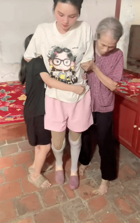 NGA TÍCH CỰC - Kênh Tiktok của mẹ 2 con mất tứ chi sau cơn bạo bệnh: Kiên cường tập luyện với đôi chân  NGA TÍCH CỰC - Kênh Tiktok của mẹ 2 con mất tứ chi sau cơn bạo bệnh: Kiên cường tập luyện với đôi chân