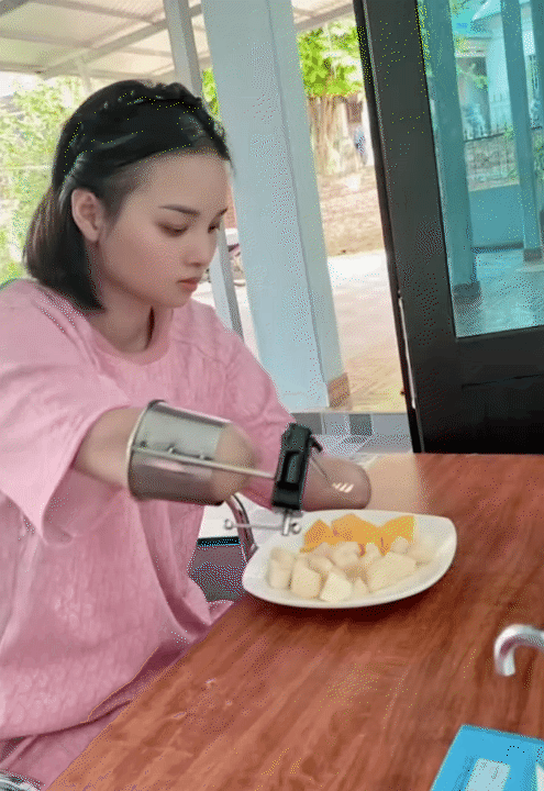 NGA TÍCH CỰC - Kênh Tiktok của mẹ 2 con mất tứ chi sau cơn bạo bệnh: Kiên cường tập luyện với đôi chân  NGA TÍCH CỰC - Kênh Tiktok của mẹ 2 con mất tứ chi sau cơn bạo bệnh: Kiên cường tập luyện với đôi chân