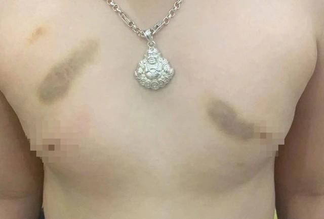 Phụ huynh tố giáo viên mầm non bạo hành trẻ, yêu cầu bồi thường 1 năm học phí? - Ảnh 1. Phụ huynh tố giáo viên mầm non bạo hành trẻ, yêu cầu bồi thường 1 năm học phí? - Ảnh 1.