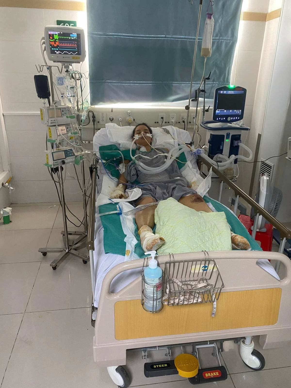 NGA TÍCH CỰC - Kênh Tiktok của mẹ 2 con mất tứ chi sau cơn bạo bệnh: Kiên cường tập luyện với đôi chân  NGA TÍCH CỰC - Kênh Tiktok của mẹ 2 con mất tứ chi sau cơn bạo bệnh: Kiên cường tập luyện với đôi chân