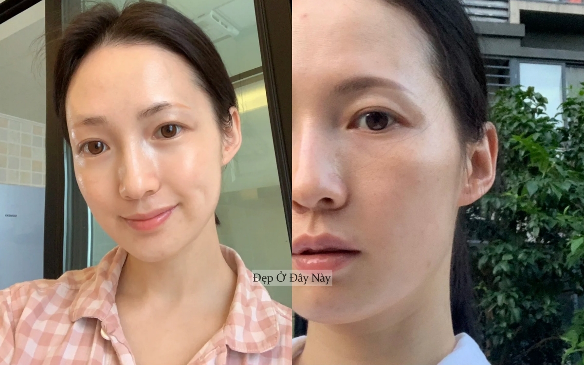 Tôi 31 tuổi và chưa từng sợ lão hóa nhờ 5 cách bảo tồn collagen để da căng bóng mỗi ngày - Ảnh 2. Tôi 31 tuổi và chưa từng sợ lão hóa nhờ 5 cách bảo tồn collagen để da căng bóng mỗi ngày - Ảnh 2.