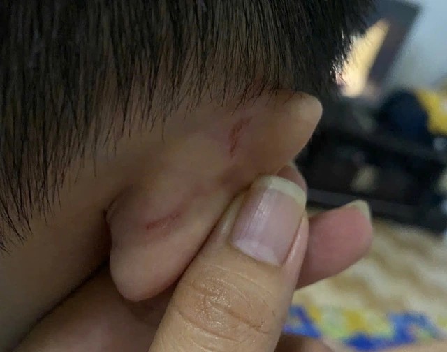 Phụ huynh tố giáo viên mầm non bạo hành trẻ, yêu cầu bồi thường 1 năm học phí? - Ảnh 2. Phụ huynh tố giáo viên mầm non bạo hành trẻ, yêu cầu bồi thường 1 năm học phí? - Ảnh 2.