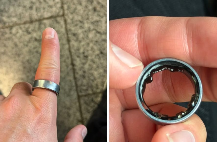 Người dùng hốt hoảng khi một sản phẩm của Samsung phồng pin, kẹt luôn trên ngón tay: &quot;Vừa đau vừa sợ nổ&quot; - Ảnh 1.