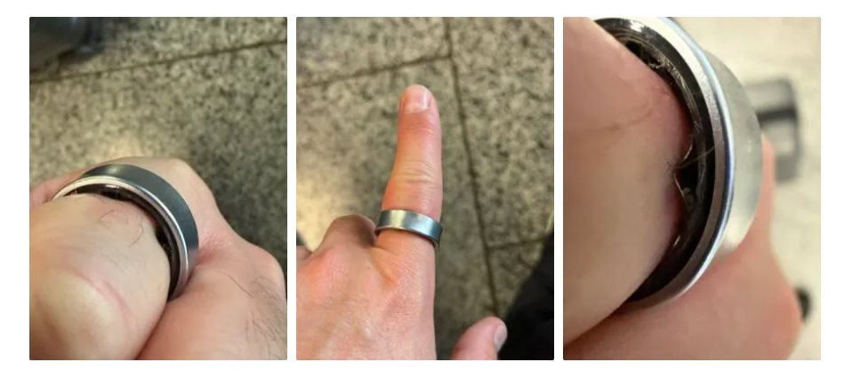 Người dùng hốt hoảng khi một sản phẩm của Samsung phồng pin, kẹt luôn trên ngón tay: &quot;Vừa đau vừa sợ nổ&quot; - Ảnh 2.