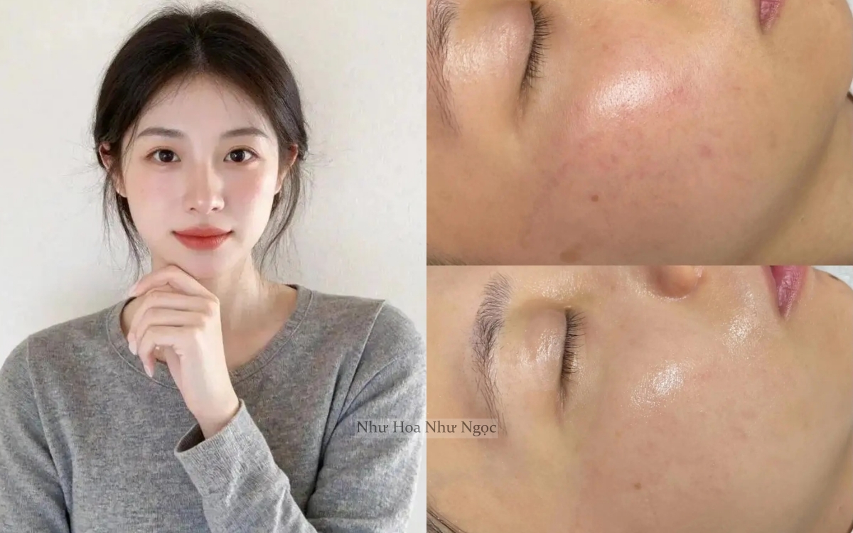 Tôi đã tìm ra cách &quot;bơm&quot; collagen cho da căng mướt tới độ không ai ngờ đã 35 tuổi - Ảnh 1.