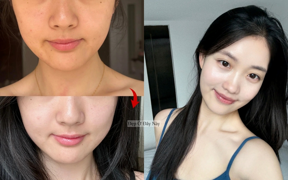 BTV chọn ra 5 sản phẩm làm trắng da, ngừa nám toàn diện ai dùng cũng mê - Ảnh 1. BTV chọn ra 5 sản phẩm làm trắng da, ngừa nám toàn diện ai dùng cũng mê - Ảnh 1.