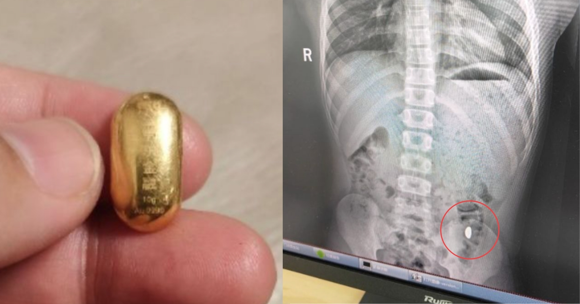 Con trai nuốt miếng vàng của mẹ vào bụng và cái kết - Ảnh 1. img