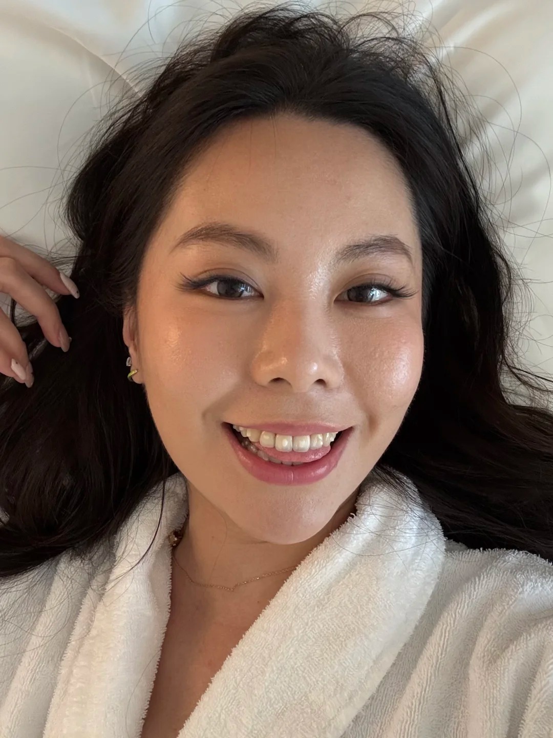 Niềng răng sứ và niềng trong suốt: Chọn gì để có nụ cười đẹp nhất? - Ảnh 4. Niềng răng sứ và niềng trong suốt: Chọn gì để có nụ cười đẹp nhất? - Ảnh 4.