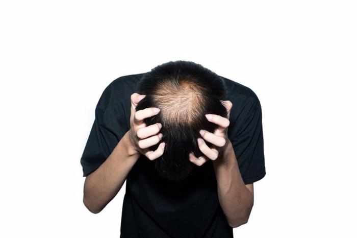 Người đàn ông 34 tuổi bị ngứa da đầu và qua đời sau 3 tháng: 4 cơn ngứa ngáy này xuất hiện thì có thể là bệnh nghiêm trọng hoặc ung thư- Ảnh 2. Người đàn ông 34 tuổi bị ngứa da đầu và qua đời sau 3 tháng: 4 cơn ngứa ngáy này xuất hiện thì có thể là bệnh nghiêm trọng hoặc ung thư- Ảnh 2.