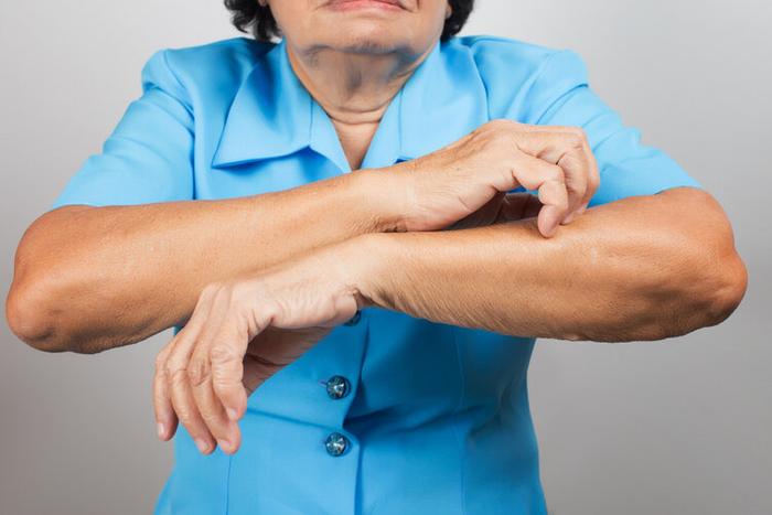 Người đàn ông 34 tuổi bị ngứa da đầu và qua đời sau 3 tháng: 4 cơn ngứa ngáy này xuất hiện thì có thể là bệnh nghiêm trọng hoặc ung thư- Ảnh 5. Người đàn ông 34 tuổi bị ngứa da đầu và qua đời sau 3 tháng: 4 cơn ngứa ngáy này xuất hiện thì có thể là bệnh nghiêm trọng hoặc ung thư- Ảnh 5.