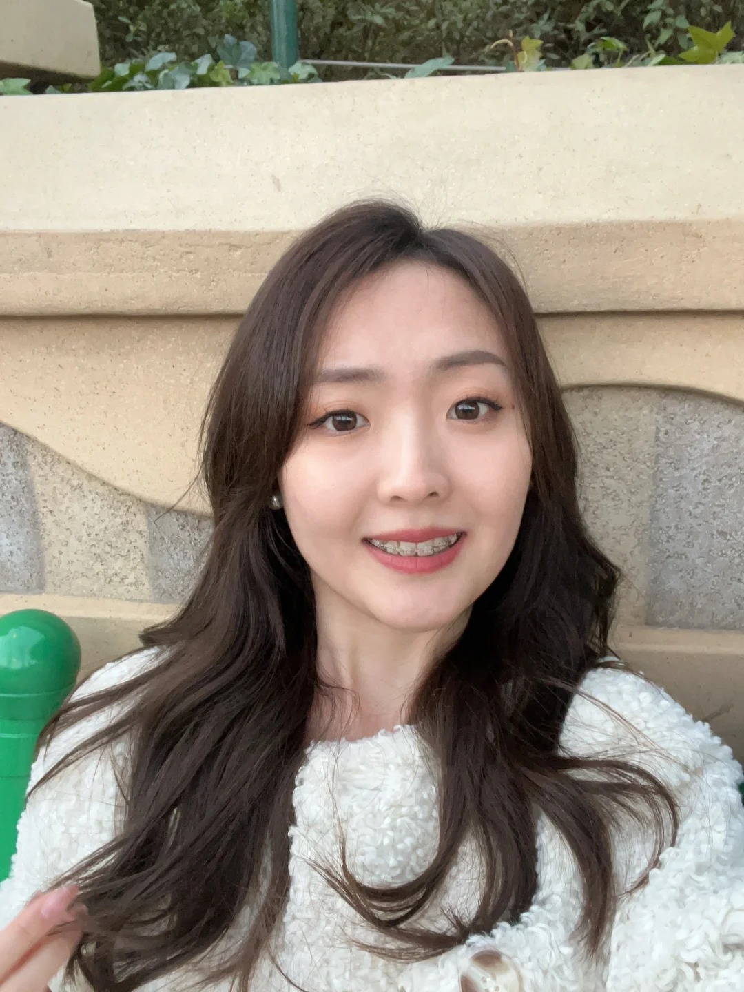 Niềng răng sứ và niềng trong suốt: Chọn gì để có nụ cười đẹp nhất? - Ảnh 6. Niềng răng sứ và niềng trong suốt: Chọn gì để có nụ cười đẹp nhất? - Ảnh 6.